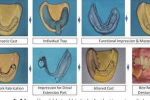 Step-by-Step: Partial Denture Process, Start to Finish Guide Best Final Touch: Elevate Your Projects with Professional Finishing Step-by-Step: Partial Denture Process, Start to Finish Guide | Best Final Touch: Elevate Your Projects with Professional Finishing