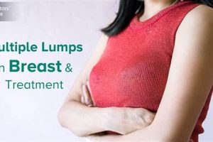 Breast Lump After Breastfeeding: Causes, Concerns & What's Next Best Final Touch: Elevate Your Projects with Professional Finishing Breast Lump After Breastfeeding: Causes, Concerns & What's Next | Best Final Touch: Elevate Your Projects with Professional Finishing