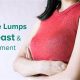 Breast Lump After Breastfeeding: Causes, Concerns &amp; What's Next | Best Final Touch: Elevate Your Projects with Professional Finishing