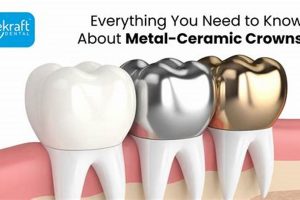 Achieve Perfection - Crown Metal Finishing Services Near You Best Final Touch: Elevate Your Projects with Professional Finishing Achieve Perfection - Crown Metal Finishing Services Near You | Best Final Touch: Elevate Your Projects with Professional Finishing