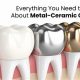 Achieve Perfection - Crown Metal Finishing Services Near You | Best Final Touch: Elevate Your Projects with Professional Finishing