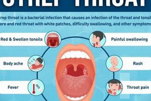 Help! Strep Came Back After Antibiotics? (Reddit Advice) | Best Final Touch: Elevate Your Projects with Professional Finishing
