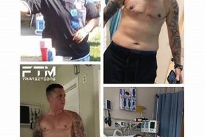 Achieving Completion: Finished FTM Bottom Surgery Guide | Best Final Touch: Elevate Your Projects with Professional Finishing