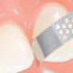 Achieve Perfect Polish: Finishing Strips Dental Guide | Best Final Touch: Elevate Your Projects with Professional Finishing